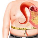 Diagnoza in zdravljenje maščobne jetrne hepatoze