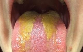 Warum hat die Zunge einen gelben Belag?