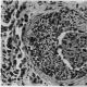 Medicininė mokomoji literatūra Patanatomija lėtinis pielonefritas po mikroskopu