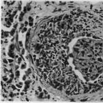 Literatură educațională medicală Patanatomie pielonefrită cronică la microscop