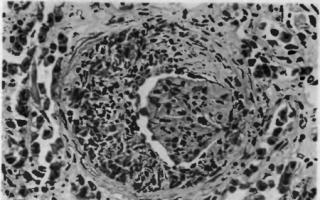 Медицинская учебная литература Патанатомия хронический пиелонефрит под микроскопом