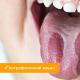 Ursachen und Behandlung von gelber Plaque in der Zunge